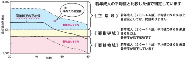 超音波骨評価　結果票の見方