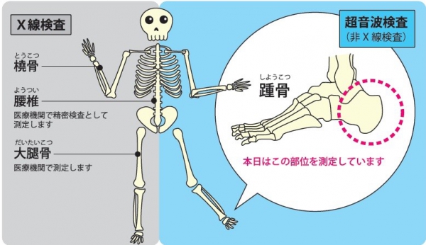 骨検査と測定部位と測定方法